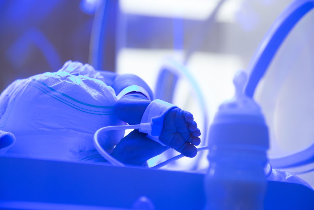 baby in intensive care unit in a medical incubator under ultraviolet lamp.
